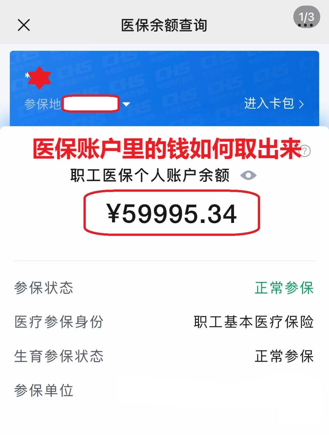 松原为什么医保卡里没有钱(为什么医保卡里没有钱还可以报销)