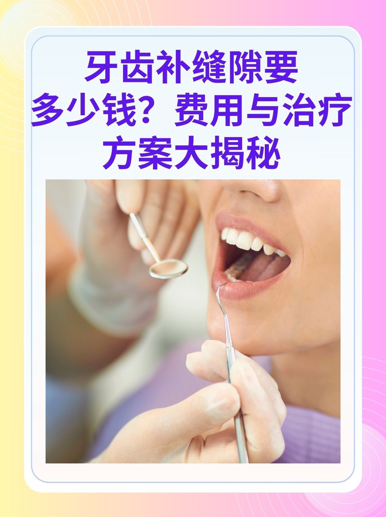 松原补牙医保可以报销吗(补牙医保可以报销吗 哪些可以报销呢)